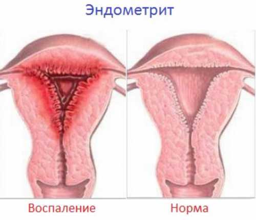 Длительную продолжительность родов