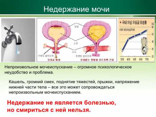 Стресс