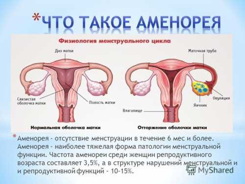 Раннее половое созревание у мамы и бабушки во многом определяют возраст наступления месячных у ребенка