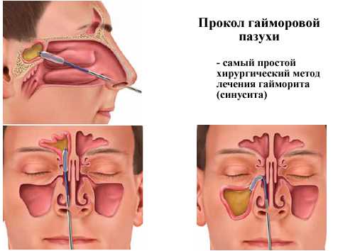 Смягчающие паровые или водные ванны для прогревания головы