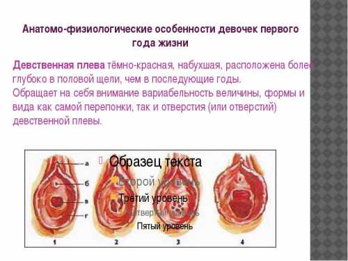 Стоит сказать, что согласно медицинским статистическим данным, есть определенный процент девочек, которые от рождения не имеют гимена