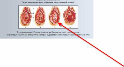 Как выглядит девственная плева